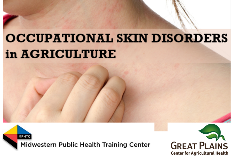 Occupational Skin Disorders in Agriculture
